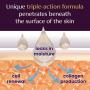 Mederma PM Intensive Overnight Scar Cream, Works with Skin's Nighttime Regenerative Activity, Clinically Shown to Make Scars Smaller and Less Visible, 1.7 Oz (48g)