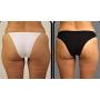 Cellulite Cold Slimming Gel with Caffeine and Green Tea Extract - Reduce Appearance of Cellulite, Stretch Marks, Firming and Toning, Improves Circulation - Quick Absorption- Cryo Gel (1 Jar)