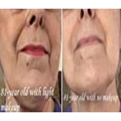 Retinol Cream for Face and Eye - Night Facial Cream Moisturizer with Hyaluronic Acid, Jojoba Oil - Anti Aging, Diminishes Wrinkles, Fine Lines and Acne 2 oz.