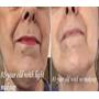Retinol Cream for Face and Eye - Night Facial Cream Moisturizer with Hyaluronic Acid, Jojoba Oil - Anti Aging, Diminishes Wrinkles, Fine Lines and Acne 2 oz.