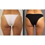 Cellulite Cold Slimming Gel with Caffeine and Green Tea Extract - Reduce Appearance of Cellulite, Stretch Marks, Firming and Toning, Improves Circulation - Quick Absorption- Cryo Gel (1 Jar)