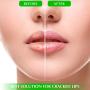 Moisturizing Green Tea Matcha Sleeping Lip Mask Balm, Younger Looking Lips Overnight, Best Solution For Chapped And Cracked Lips, Unique Lip Gloss Formula And Power Benefits Of Green Tea (Matcha)