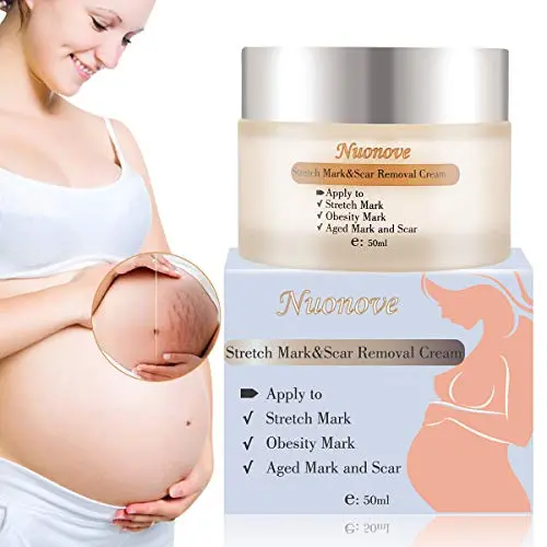 Striae Postpartale Creme – Entfernt & Reduziert Schwangerschaftsstreifen, Beckenhernie-Creme, Postpartum Fettcreme, Für Schwangerschaftsstreifen, Wundheilende Creme