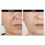 DNA Code-No Needle Alternative-Argireline NeuroPeptides Wrinkle Reduce Cream w/Matrixyl 3000, Syn-Ake, SNAP-8, Copper Peptides