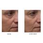 Dr. Denese SkinScience Advanced Firming Facial Pads Exfoliate & Deeply Cleanse Pores with Actizone Firming Factor, Glycolic Acid, Peptides & Aloe Vera - Vegan, Paraben-Free, Cruelty-Free - 100 Count