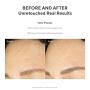 Murad Resurgence Retinol Youth Renewal Night Cream - Retinol Cream for Lines and Wrinkles - Anti-Aging Night Face Cream - Night Cream for Face Firming and Smoothing, 1.7 Fl Oz