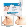Vincere Anti Melasma Cream Reduces Dark & Brown Spots, Age Spots, Sun Spots, Pigmentation, Freckles : 1 Piece