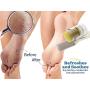 Magic Heal Cracked Heel Balm For Cracked Heels - Dry Feet Lotion to Soothe, Moisturize & Beautify Your Painful Dry Foot Skin - Includes Bonus Foot File - Amazing, Fast Results, No Mess Application