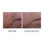 Perricone MD Cold Plasma Plus