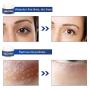 Under Eye Cream, Eye Repair Cream, Anti-Aging Eye Cream, Eye Cream for Dark Circles & Puffiness & Under Eye Bags, Nourishes Skin & Fights Wrinkles, Rapid Wrinkle Repair Eye Skin
