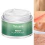 Scar Removal Cream Advanced Treatment for Old & New Scars from Cuts Stretch Marks, C-Sections & Surgeries With Natural Herbal Extracts Formula