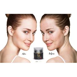 Retinol Anti-Aging Moisturizer Cream for Face, Neck, Wrinkles, Acne and Eye Area , 1.7 FL oz