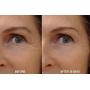 DNA CODE-20% Pumpkin Enzyme Peel 2 oz-Enhanced w/Vita.C, B1, B12, CoQ10, Lactic acid