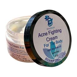 Acne Fighting Cream For The Body, 4oz Jar