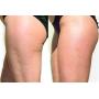 Cellulite Cold Slimming Gel with Caffeine and Green Tea Extract - Reduce Appearance of Cellulite, Stretch Marks, Firming and Toning, Improves Circulation - Quick Absorption- Cryo Gel (1 Jar)