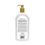 Amazon Brand - Solimo Diabetics Skin Moisturizing Lotion, Fragrance Free, 13 Ounces