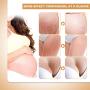 Stretch Mark Cream for Pregnancy, Stretch Mark Scar Cream, Postpartum Obesity Pregnancy Cream, Remove Stretch Marks From Pregnancy, Repair Scar Slack Line Abdomen Stretch Marks Postpartum