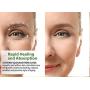 Organic Eye Cream Dark Circles Anti-Aging Moisturizer With Natural Retinol Alternative & Matrixyl. Brightening Treatment Reduces Puffiness, Under Eye Bags, Wrinkles & Fine Lines. LuxeOrganix (1 OZ)