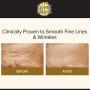 Glycolic Acid 15% Anti-Wrinkle Cream- Extra strength, Alpha Hydroxy Acid enhanced with Green Tea Extract by Beauty Facial Extreme.
