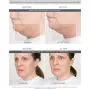 Lure Essentials GLAM Gesichtszucchettoset mit Silikonpinsel | Anti-Aging Gesichtsstraffung Cupping Massage | KOSTENLOSER PDF-Band für professionelle und private Anwendung