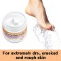 Lagunamoon Foot Cream for Dry Cracked Feet, Urea, Vitamin E & Hyaluronic Acid Foot Moisturizer for Dry, Rough, Calloused, Cracked Feet Repair and Soften, Non-Greasy & Fast Absorbing, 5.3 oz
