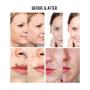 Ariella Mole and Skin Tag Remover and Repair Lotion Set, Remove Moles and Skin Tags