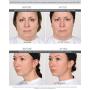 Lure Essentials GLAM Face Cupping Set Facial Set with Silicone Brush | Anti-Aging Face Lift Cupping Massage | FREE PDF Book for Professional and Home Use