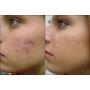 DNA CODE-20% Pumpkin Enzyme Peel 2 oz-Enhanced w/Vita.C, B1, B12, CoQ10, Lactic acid