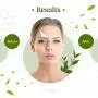 Night Cream Anti Aging Wrinkle Cream With Growth Factors (EGF, IGF-1, FGF and VEGF) & Niacinamide | Reduce Appearance of Acne Scars, Marks, Wrinkles, and Dark Spots - Helps with Old Scar Removal (1.7) Night Cream Anti Aging Wrinkle Cream With Growth Factors (EGF, IGF-1, FGF and VEGF) & Niacinamide | Reduce Appearance of Acne Scars, Marks, Wrinkles, and Dark Spots - Helps with Old Scar Removal (1.7)