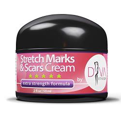 Stretch Mark and Scar Removal Cream by DIVA Fit & Sexy - Made with Natural and Organic Herbal Extracts!