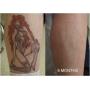 Tattoo Removal Cream Natural Fading system wrecking balm 2 week spartan perform
