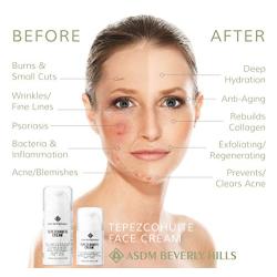 ASDM Beverly Hills Tepezcohuite Face Cream 4oz 120ml Collagen Booster w/Hyaluronic Acid, Anti-Aging, Remove Wrinkle, Acne Scar, Eczema, Anti-Inflammatory,Calming Hydrate Sensitive Healing Moisturizer