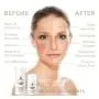 Crème Visage Tepezcohuite 4oz/120ml – Boosteur de Collagène avec Acide Hyaluronique, Anti-Âge, Réduit les Rides, l'Effacement des Acné, l'Eczéma, Anti-Inflammatoire, Apaise et Hydrate la Peau Sensible et Guérisse. Crème Visage Tepezcohuite 4oz/120ml – Boosteur de Collagène avec Acide Hyaluronique, Anti-Âge, Réduit les Rides, l'Effacement des Acné, l'Eczéma, Anti-Inflammatoire, Apaise et Hydrate la Peau Sensible et Guérisse.