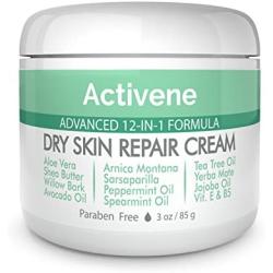 Activene Dry Skin Repair Cream - All-Purpose Moisturizing Formula with 12 Powerful Natural Ingredients to Soothe and Hydrate Very Dry, Chapped Skin (3 oz). Paraben Free (Naturally Scented)