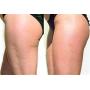 Cellulite Cold Slimming Gel with Caffeine and Green Tea Extract - Reduce Appearance of Cellulite, Stretch Marks, Firming and Toning, Improves Circulation - Quick Absorption- Cryo Gel (1 Jar)