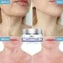 HSBCC Neck Firming Cream with Peptides,Neck Cream,Neck Moisturizer Cream,Anti Wrinkle Anti Aging Neck Lifting Cream for Neck, Advanced Stem Cell + Collagen Formula For Tightening & Lifting Sagging Ski HSBCC Neck Firming Cream with Peptides,Neck Cream,Neck Moisturizer Cream,Anti Wrinkle Anti Aging Neck Lifting Cream for Neck, Advanced Stem Cell + Collagen Formula For Tightening & Lifting Sagging Ski