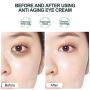 Eye Cream - Under Eye Treatment for Anti Aging, Dark Circles, Eye Bag & Puffiness, Eye Wrinkle Cream with 43% Aloe Vera, Retinol, Vitamin C & E Eye Treatment for Men / Womens Eye Cream