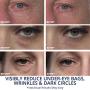 Plexaderm Rapid Reduction Serum - New Single Use Pods - Age-Defying Eye Treatment - Reduce the Look of Under-Eye Bags & Wrinkles, Diminish the Appearance of Dark Circles, Fine Lines & Crow’s Feet