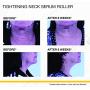 StriVectin Tightening Neck Serum Roller, 1.7 Fl Oz