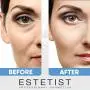 Caffeine Infused Coffee Eye Lift Cream - Reduces Puffiness, Brightens Dark Circles, & Firms Under Eye Bags - Anti Aging, Wrinkle Fighting Skin Treatment Caffeine Infused Coffee Eye Lift Cream - Reduces Puffiness, Brightens Dark Circles, & Firms Under Eye Bags - Anti Aging, Wrinkle Fighting Skin Treatment