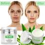 SWAN STAR Natural Retinol Cream Moisturizer for Face, With Vitamin E & Hyaluronic Acid, Anti Aging and Wrinkles - Best Night & Day Facial Cream 1.7 fl oz