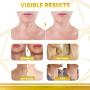 Neck Firming Cream, Anti Aging Moisturizer, Skin Tightening and Crepe Skin Repair Cream, Double Chin Reducer 2 Fl Oz.