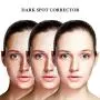 EnaSkin Dark Spot Corrector Remover for Face and Body,Formulated with Advanced Ingredient 4-Butylresorcinol, Kojic Acid, Lactic Acid and Salicylic Acid