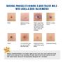 Ariella Mole and Skin Tag Remover and Repair Lotion Set, Remove Moles and Skin Tags