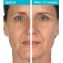 MD Complete Wrinkle & Radiance Remedy PLUS Anti Aging Face Cream with Retinol