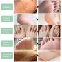 Foot Exfoliation, Foot Scrub, Foot mask to Remove Cornea, Foot Callus Remover, Natural exfoliator Dry Skin Remover softens for Thick Cracked Dry Heel feet, Dead Skin Remover Baby feet, 150g