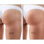 Body Merry Stretch Marks & Scars Defense Oil w All Natural Coconut Oil + Rosehip + Jojoba + Tamanu + Sea Buckthorn to Combat Signs of Stretch Marks, Scars
