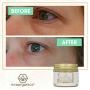 Rejuvenating Eye Cream Extra Nourishing & Moisturizing USDA Organic Anti Aging Eye Treatment Balm for Dark Circles, Under Eye Bags, Puffiness & Wrinkles with Jojoba Oil, Argan Oil & More Era-Organics