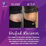 Vanna Belt: Gel-V - 8.8oz - Formulated to Fade Stretch Marks - Made to Tighten Sagging Skin - Perfect for Areas That Diet and Exercise Miss (Stomachs, Thighs, Hips)