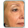 Stem Cell Therapy by BioLogic Solutions (Set of 2 Jars)